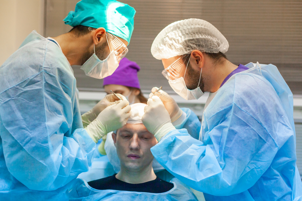Hair Transplant in Turkey Cost Calculator - Check Exact Cost